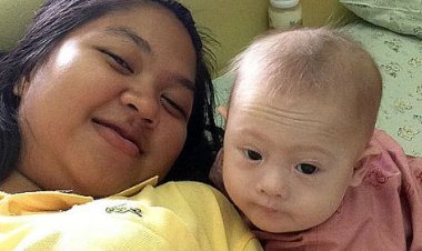 Bebê com síndrome de Down abandonado recebe US$ 200 mil em doações