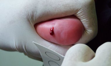 APAE de Batatais amplia ações na prevenção de deficiências